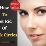 how to get rid of dark circle permanently 1